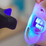 Teeth Whitening in Riyadh