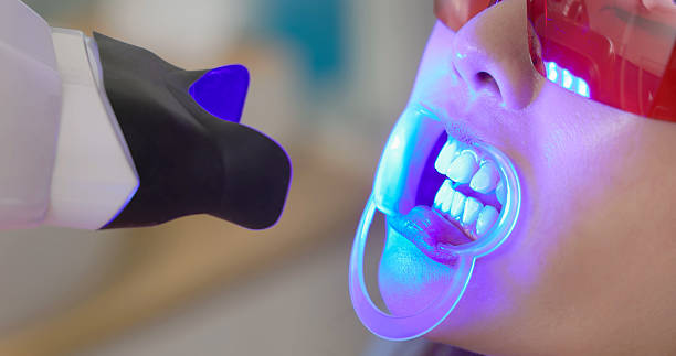 Teeth Whitening in Riyadh