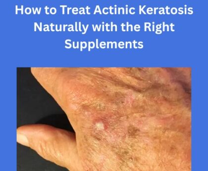 How to Treat Actinic Keratosis Naturally