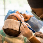 Hair transplant in Dubai