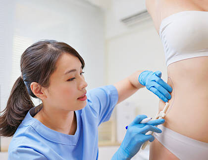 Liposuction surgery in Dubai
