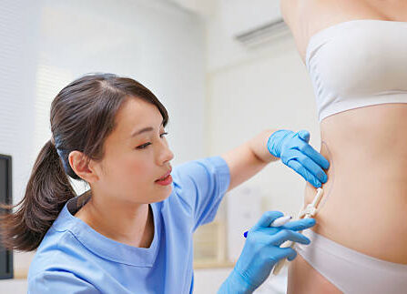 Liposuction surgery in Dubai