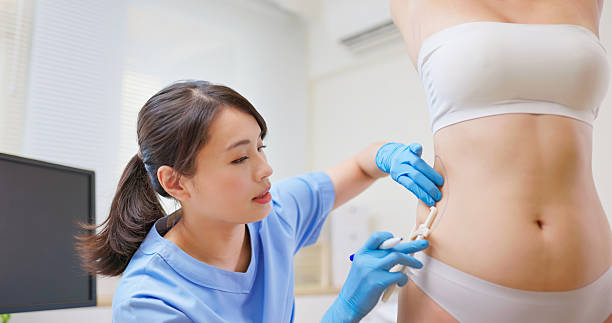 Liposuction surgery in Dubai