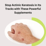 Actinic keratosis supplements for nutritional support and skin health